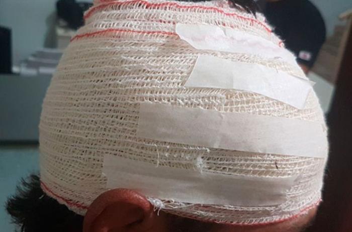 'TU É CORNO': Homem é atacado com paulada após briga com ex-marido da atual mulher