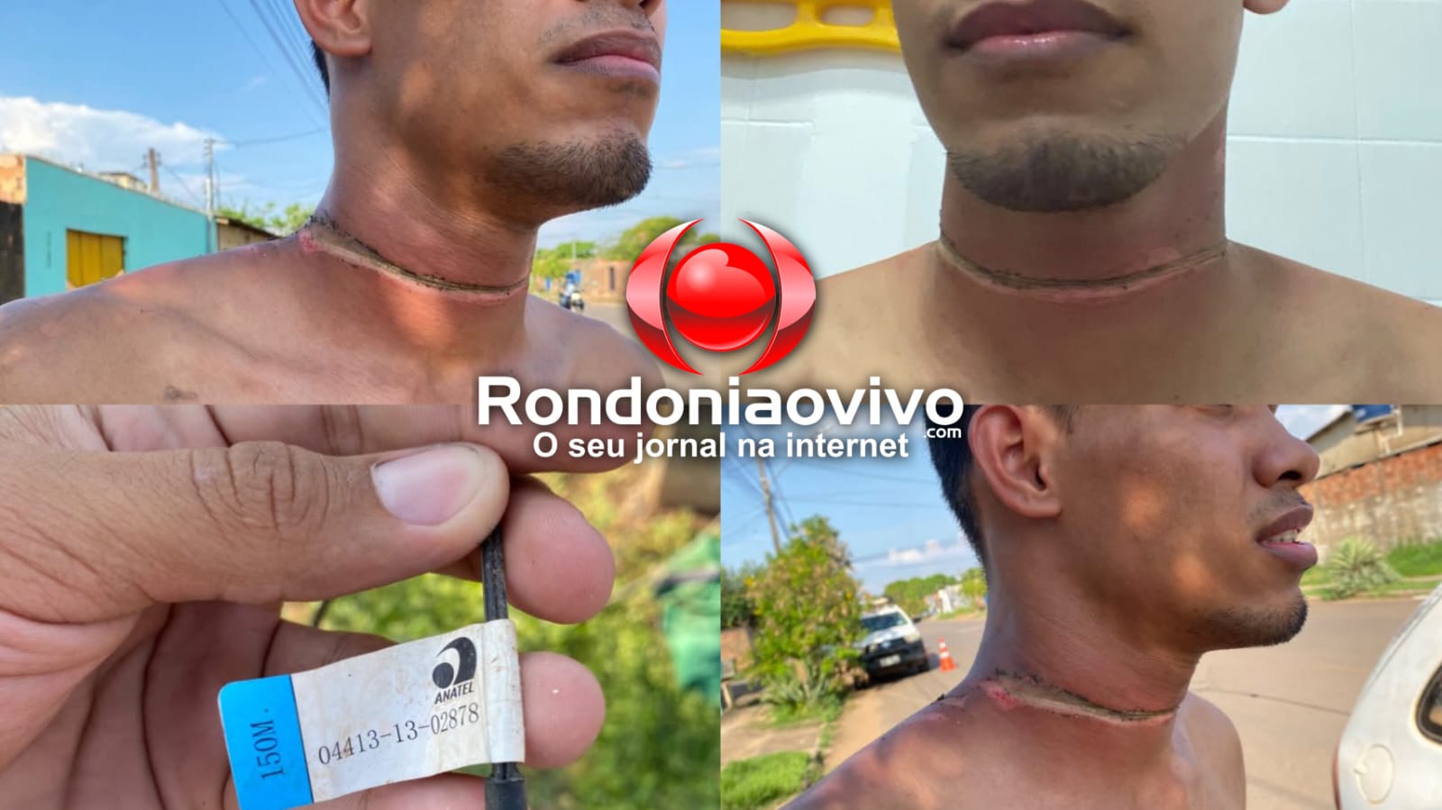 VÍDEO: Motociclista tem pescoço ferido após ser atingido por fiação baixa na zona Leste