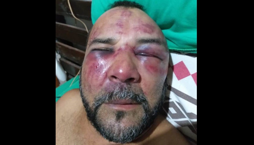 GOLPES BRUTAIS: Bombeiro é agredido após pedir carteirinha de exames de sócio de clube