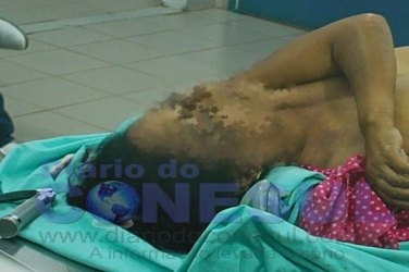 Comerciante é baleada durante assalto e não resiste ao ferimento