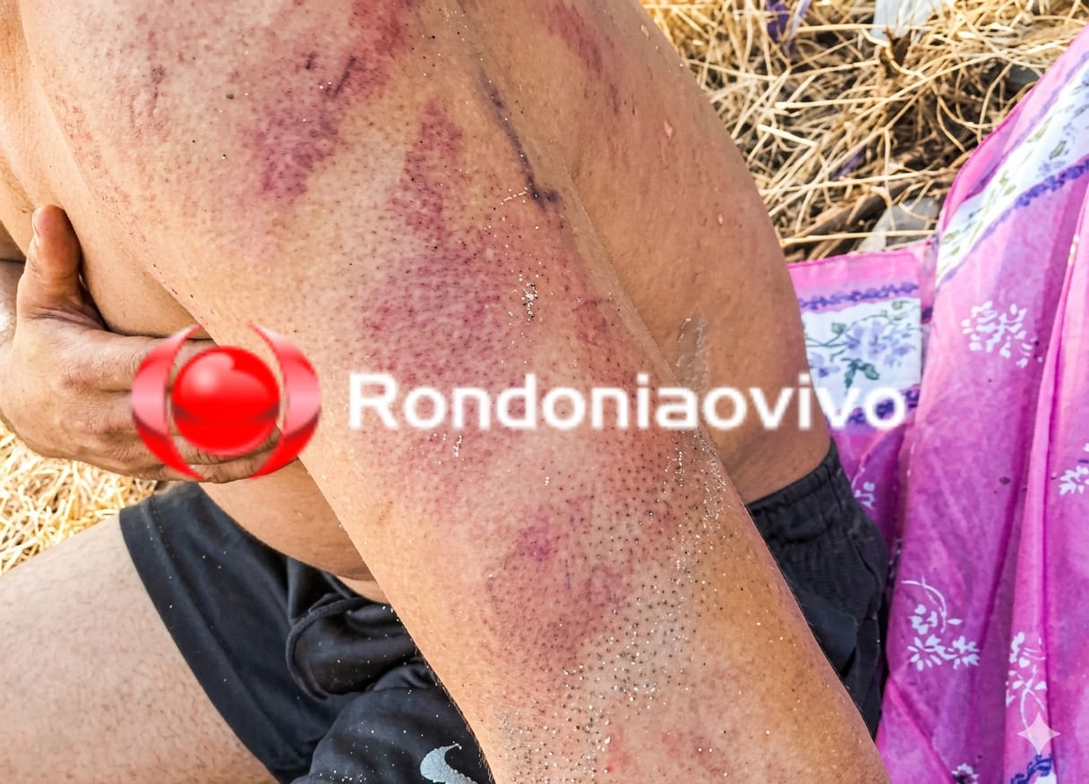 DISCIPLINA: Jovem é sequestrado e espancado por criminosos por dívida com facção 