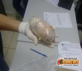 PRESÍDIO: Mulher de apenado é presa com 300 gramas de droga na vagina