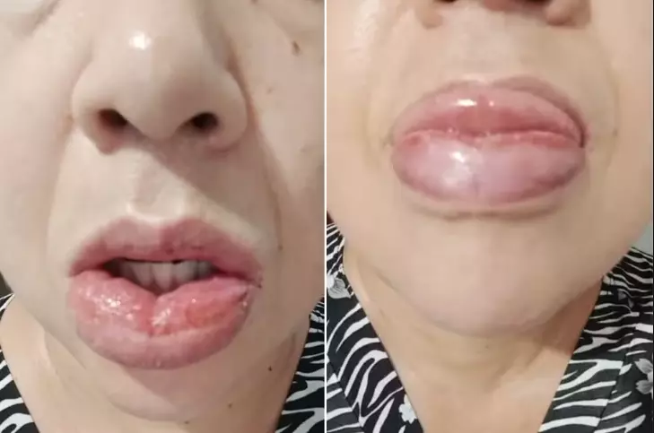 VENDA PROIBIDA: Mais de 1,2 mil pessoas relataram reação a pasta da Colgate