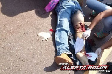 Motociclista fica gravemente ferido em acidente de trânsito