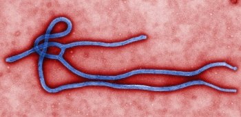 Vírus ebola pode chegar ao Brasil durante a Copa