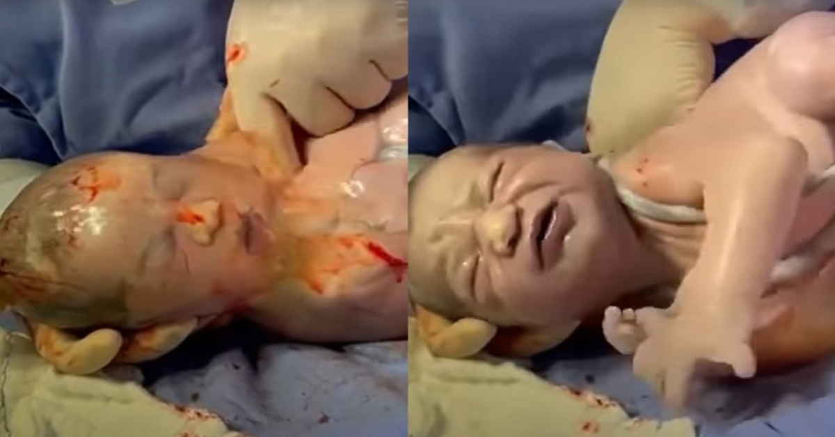 ASSISTA: Viraliza vídeo de médico furando bolsa de bebê em Vilhena