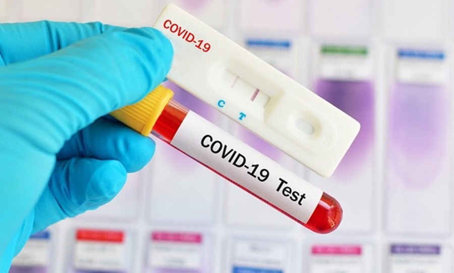 ÚLTIMAS 24H: Em RO são registrados 56 novos casos da Covid-19 e nenhuma morte