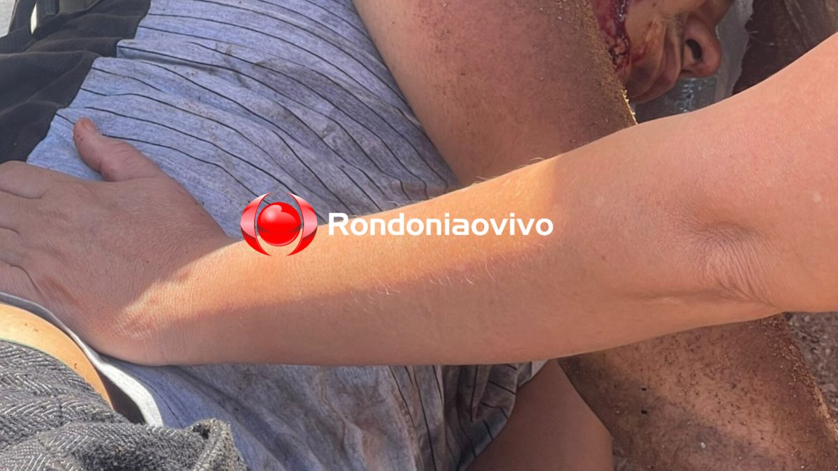 NA AMAZONAS : Adolescente fica inconsciente após acidente envolvendo caminhão baú 