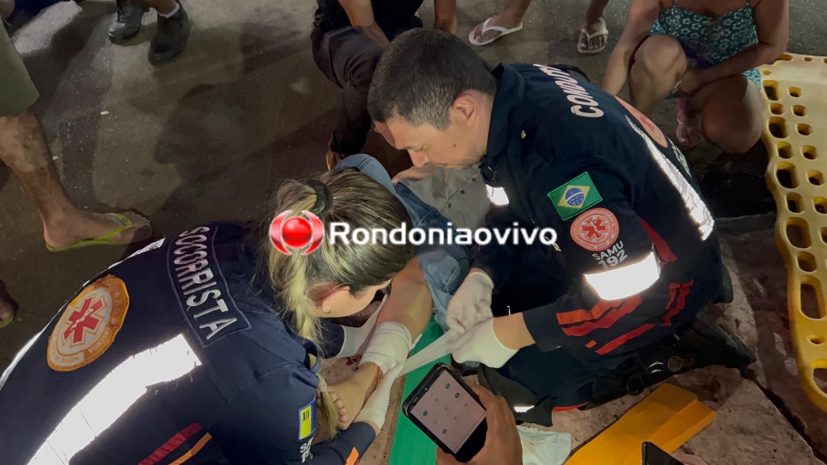 NA JATUARANA: Vídeo mostra acidente que deixou mulher com fratura exposta 