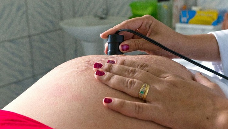 ALERTA: Mortalidade de gestantes é mais que o dobro da média no país