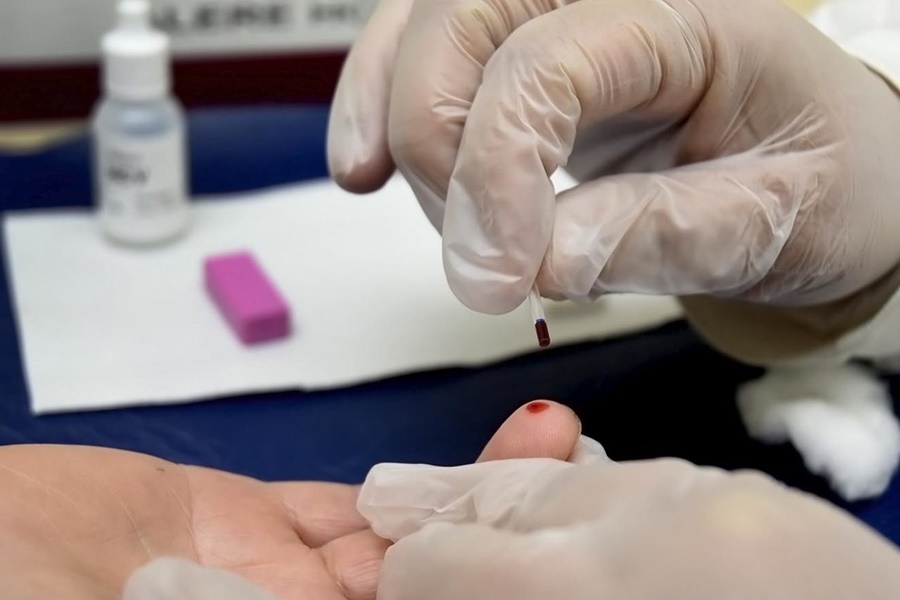 AMARELO: Unidades de Saúde na capital fazem exames para detectar hepatites