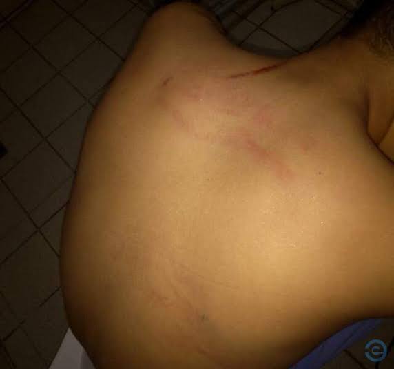 COVARDIA: Criança é agredida por bandidos e tem bicicleta roubada 