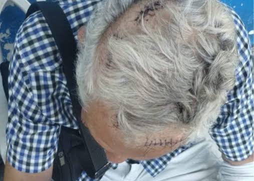 VULGO 'MOCÓ: Idoso de 71 anos é atacado com pancadas na cabeça por rival 