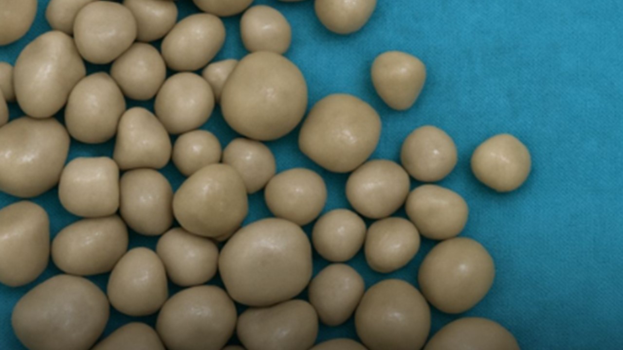 TINHA MAIS DE 300: Jovem de 20 anos evita água, bebe só refrigerantes e os rins enchem de pedras