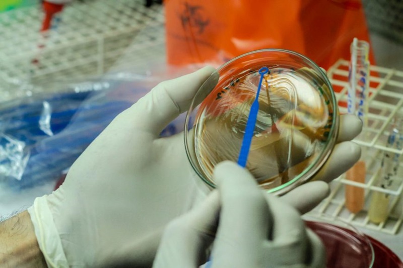 NEGATIVOS: Governo descarta casos de varíola dos macacos em Rondônia