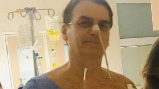 INTERNADO: Bolsonaro volta a ter febre e é diagnosticado com pneumonia