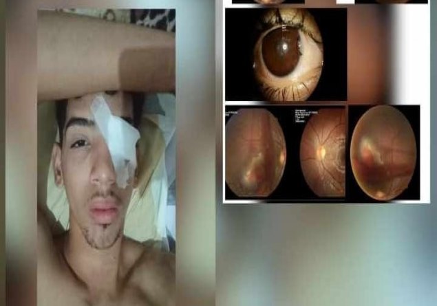 SOLIDARIEDADE: Jovem de Ji-Paraná sofre grave acidente e precisa de ajuda para cirurgia urgente